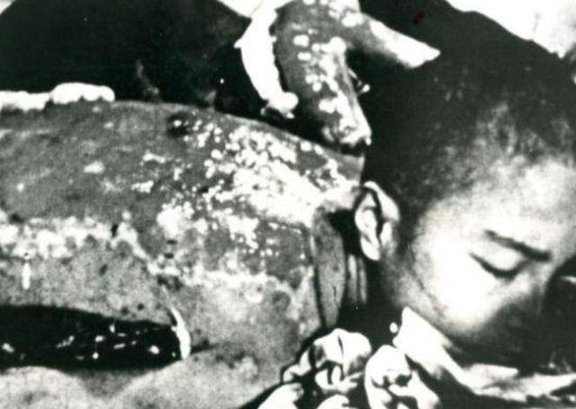 原子弹爆炸实拍：被烤成焦炭的日本人