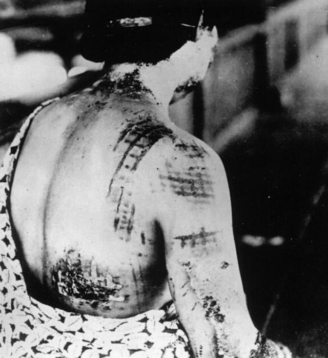 原子弹爆炸实拍：被烤成焦炭的日本人